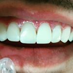 دکتر حمیده مهدوی فرد             
جراح دندانپزشک زیبایی،پروت