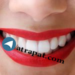 دکتر صادقی دندانپزشک زیبایی آدرس مطب :رباط کریم بلوار آزادگا