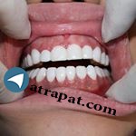   جراح دندانپزشک . کاشت ایمپلنت دندان پیوند و بازسازی استخوا